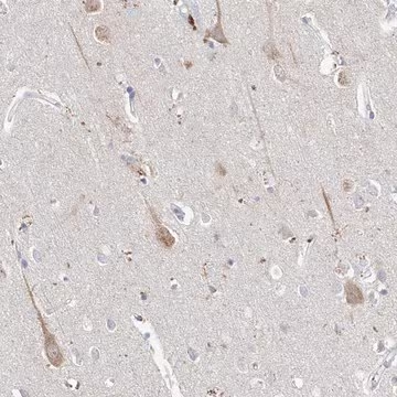 Anti-ASNS antibody produced in rabbit, 1 X 100 µL (HPA029318-100UL)