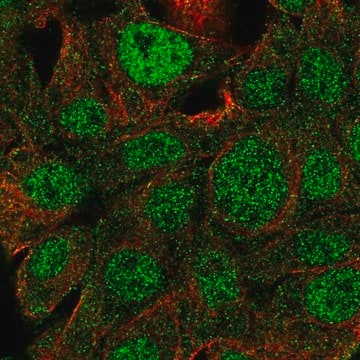 Anti-SLC2A2 antibody produced in rabbit, 100 µL (HPA028998-100UL)