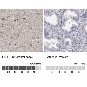 Anti-FABP7 antibody produced in rabbit, 1 X 100 µL (HPA028825-100UL)