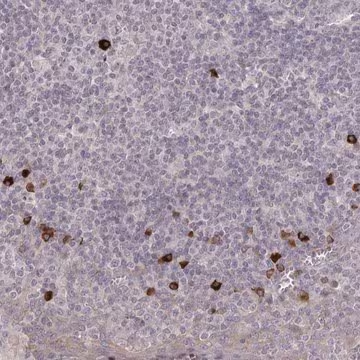 Anti-HCAR2 antibody produced in rabbit, 1 X 100 µL (HPA028660-100UL)