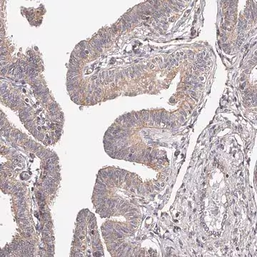 Anti-USP21 antibody produced in rabbit, 1 X 100 µL (HPA028397-100UL)