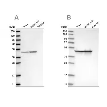 Anti-FH antibody produced in rabbit, 1 X 100 µL (HPA027341-100UL)