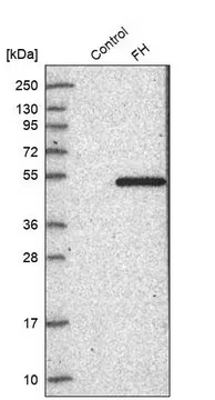 Anti-FH antibody produced in rabbit, 1 X 100 µL (HPA025948-100UL)