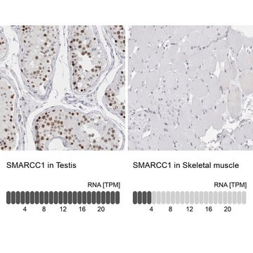 Anti-SMARCC1 antibody produced in rabbit, 1 X 100 µL (HPA024352-100UL)