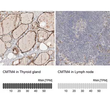 Anti-CMTM4 antibody produced in rabbit, 1 X 100 µL (HPA023890-100UL)