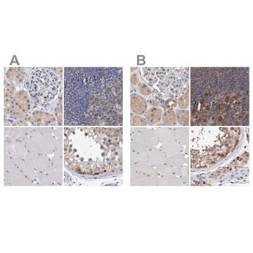 Anti-PFAS antibody produced in rabbit, 1 X 100 µL (HPA022886-100UL)