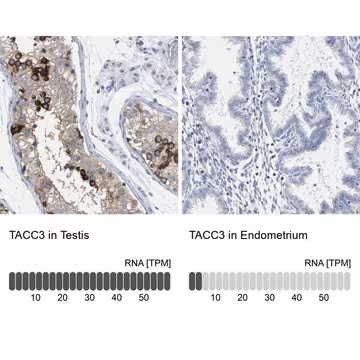 Anti-TACC3 antibody produced in rabbit, 1 X 100 µL (HPA022039-100UL)