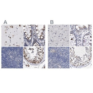 Anti-GOLGA2 antibody produced in rabbit, 1 X 100 µL (HPA021230-100UL)