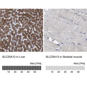 Anti-SLC25A13 antibody produced in rabbit, 1 X 100 µL (HPA018997-100UL)