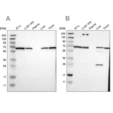 Anti-LTA4H antibody produced in rabbit, 1 X 100 µL (HPA017017-100UL)