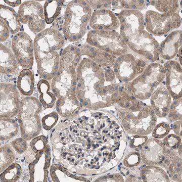 Anti-PKD2 antibody produced in rabbit, 1 X 100 µL (HPA015794-100UL)
