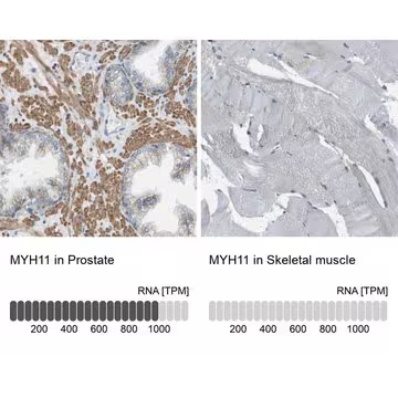 Anti-MYH11 antibody produced in rabbit, 1 X 100 µL (HPA014539-100UL)