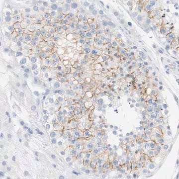 Anti-OPRM1 antibody produced in rabbit, 1 X 100 µL (HPA014509-100UL)
