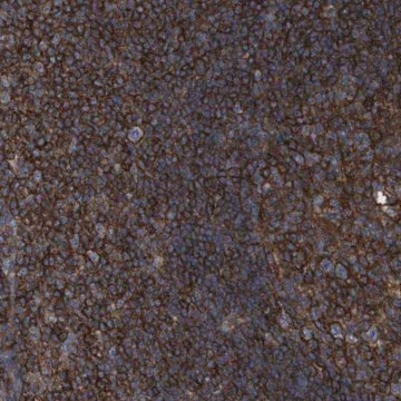 Anti-CCR6 antibody produced in rabbit, 1 X 100 µL (HPA014488-100UL)