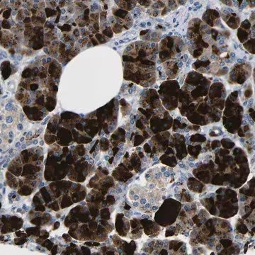 Anti-DCP1A antibody produced in rabbit, 1 X 100 µL (HPA013202-100UL)