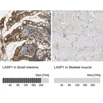 Anti-LASP1 antibody produced in rabbit, 1 X 100 µL (HPA012072-100UL)