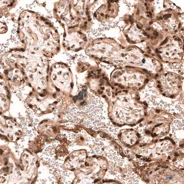 Anti-PARP14 antibody produced in rabbit, 1 X 100 µL (HPA012063-100UL)