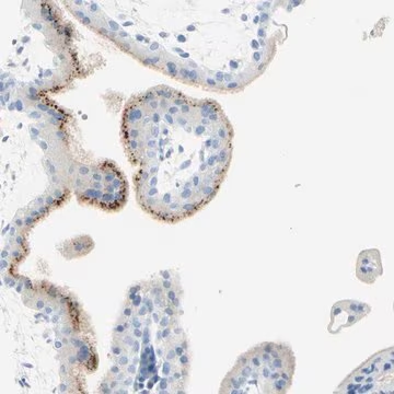 Anti-IL6ST antibody produced in rabbit, 1 X 100 µL (HPA010558-100UL)