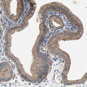 Anti-HILPDA antibody produced in rabbit, 1 X 100 µL (HPA010515-100UL)