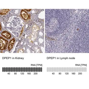 Anti-DPEP1 antibody produced in rabbit, 1 X 100 µL (HPA009426-100UL)