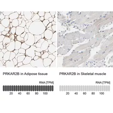 Anti-PRKAR2B antibody produced in rabbit, 1 X 100 µL (HPA008421-100UL)