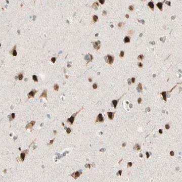 Anti-ATXN1 antibody produced in rabbit, 1 X 100 µL (HPA008335-100UL)
