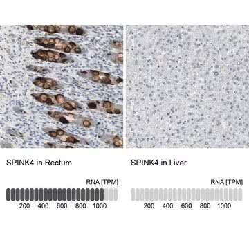Anti-SPINK4 antibody produced in rabbit, 1 X 100 µL (HPA007286-100UL)