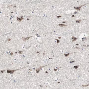 Anti-KANSL1 antibody produced in rabbit, 1 X 100 µL (HPA006874-100UL)