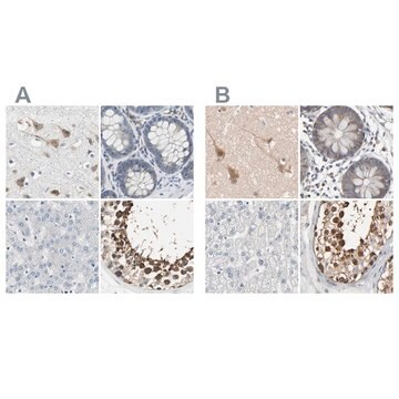 Anti-CCT5 antibody produced in rabbit, 1 X 100 µL (HPA005958-100UL)
