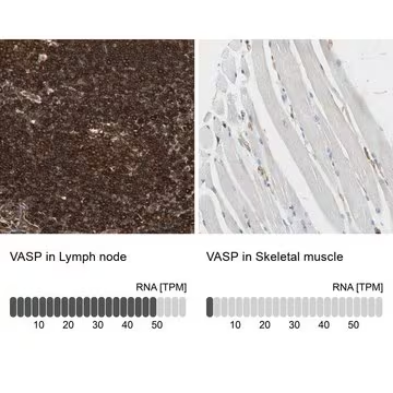 Anti-VASP antibody produced in rabbit, 1 X 100 µL (HPA005724-100UL)