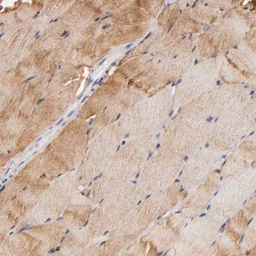 Anti-ALDOA antibody produced in rabbit, 1 X 100 µL (HPA004177-100UL)