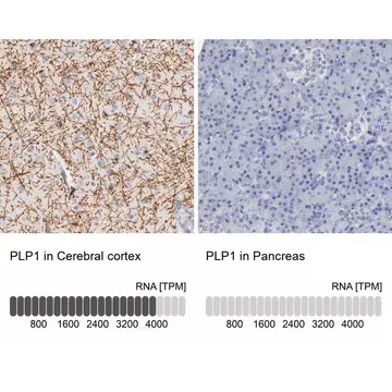 Anti-PLP1 antibody produced in rabbit, 1 X 100 µL (HPA004128-100UL)
