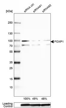 Anti-FOXP1 antibody produced in rabbit, 1 X 100 µL (HPA003876-100UL)