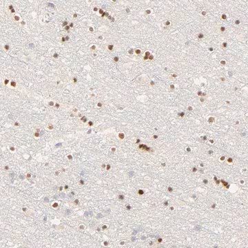 Anti-NKX2-2 antibody produced in rabbit, 1 X 100 µL (HPA003468-100UL)