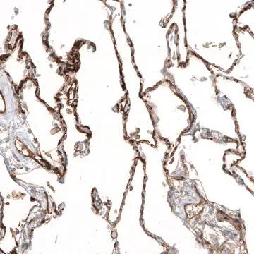 Anti-THBD antibody produced in rabbit, 1 X 100 µL (HPA002982-100UL)