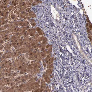 Anti-SERPINF2 antibody produced in rabbit, 1 X 100 µL (HPA001885-100UL)