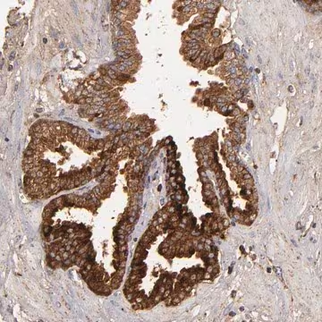 ANTI-CFB antibody produced in rabbit, 1 X 100 µL (HPA001832-100UL)