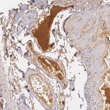 Anti-LBP antibody produced in rabbit, 1 X 100 µL (HPA001508-100UL)