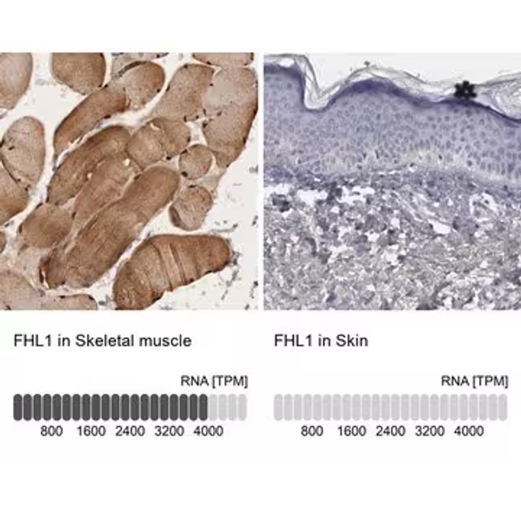 Anti-FHL1 antibody produced in rabbit, 1 X 100 µL (HPA001391-100UL)