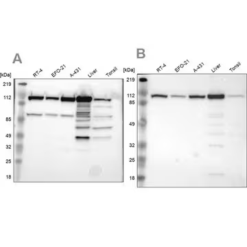 Anti-MTHFD1 antibody produced in rabbit, 1 X 100 µL (HPA001290-100UL)