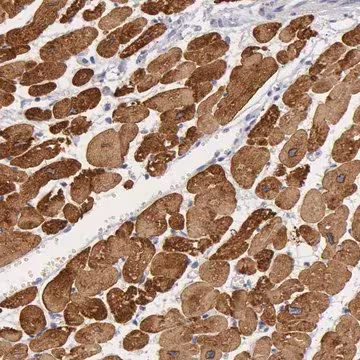 Anti-MYH7 antibody produced in rabbit, 1 X 100 µL (HPA001239-100UL)