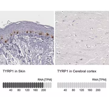 Anti-TYRP1 antibody produced in rabbit, 1 X 100 µL (HPA000937-100UL)