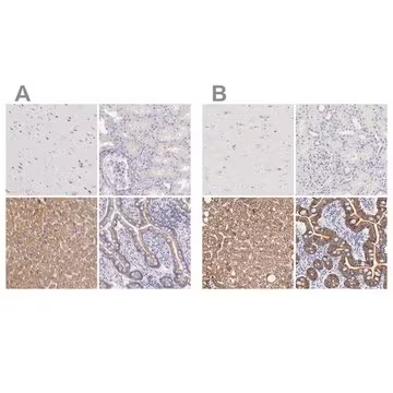Anti-OTC antibody produced in rabbit, 1 X 100 µL (HPA000570-100UL)