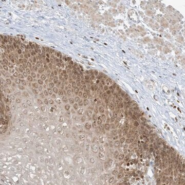 Anti-TBC1D2 antibody produced in rabbit, 1 X 100 µL (HPA030871-100UL)