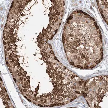 Anti-VMP1 antibody produced in rabbit, 1 X 100 µL (HPA030773-100UL)