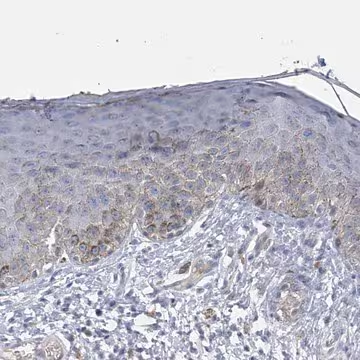 Anti-SLCO4A1 antibody produced in rabbit, 1 X 100 µL (HPA030670-100UL)