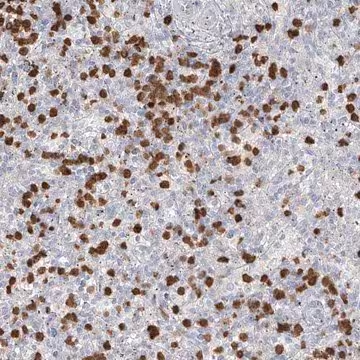 Anti-ZNF227 antibody produced in rabbit, 1 X 100 µL (HPA030573-100UL)