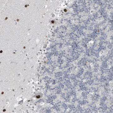 Anti-PRDM6 antibody produced in rabbit, 1 X 100 µL (HPA030324-100UL)