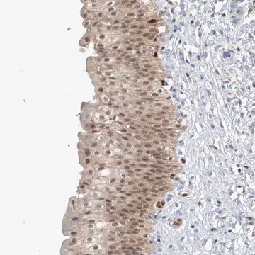 Anti-NCOA7 antibody produced in rabbit, 1 X 100 µL (HPA030291-100UL)