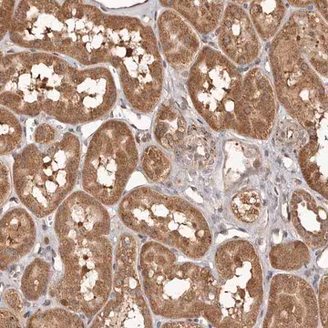 Anti-MTO1 antibody produced in rabbit, 1 X 100 µL (HPA030232-100UL)
